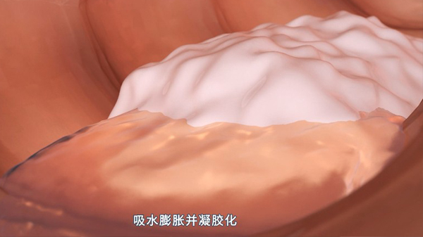 聚卡波非药物宣传