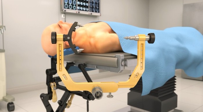 医疗头部手术动画