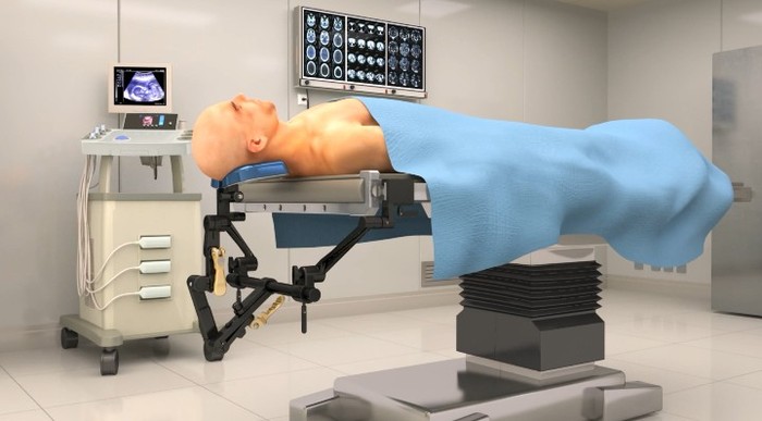 医疗头部手术动画